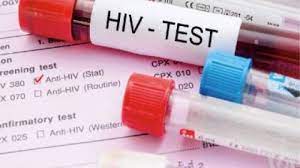 آزمایش ایدز و انواع آن