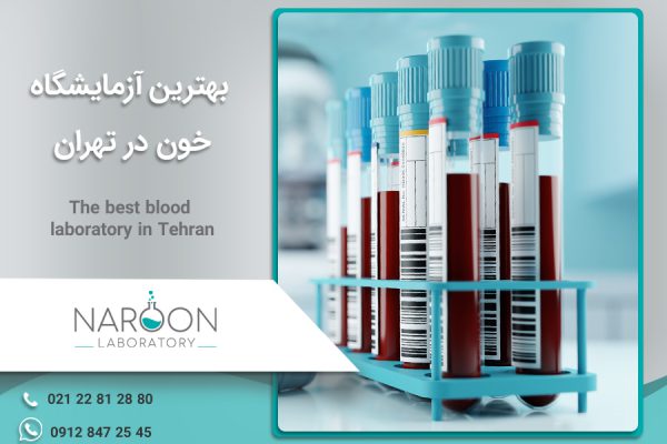 بهترین آزمایشگاه خون تهران