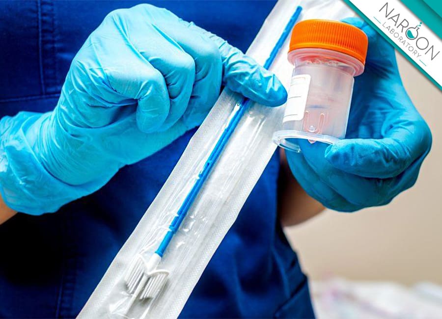 زمان آزمایش hpv