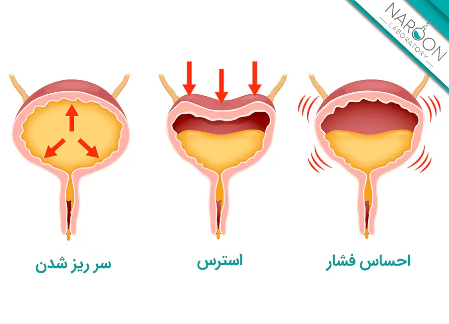 دلایل بی اختیاری ادرار
