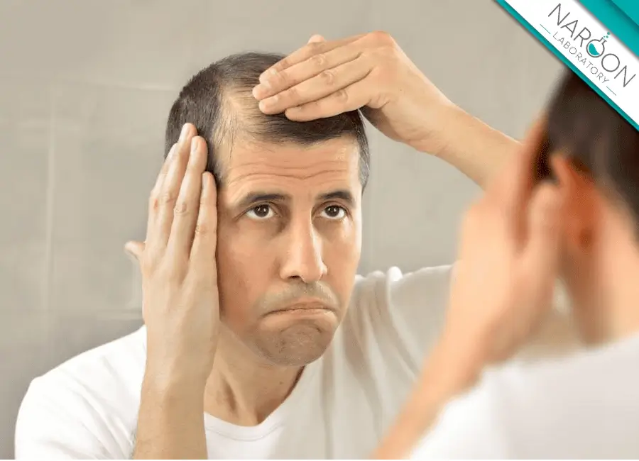 ریزش مو غیر طبیعی