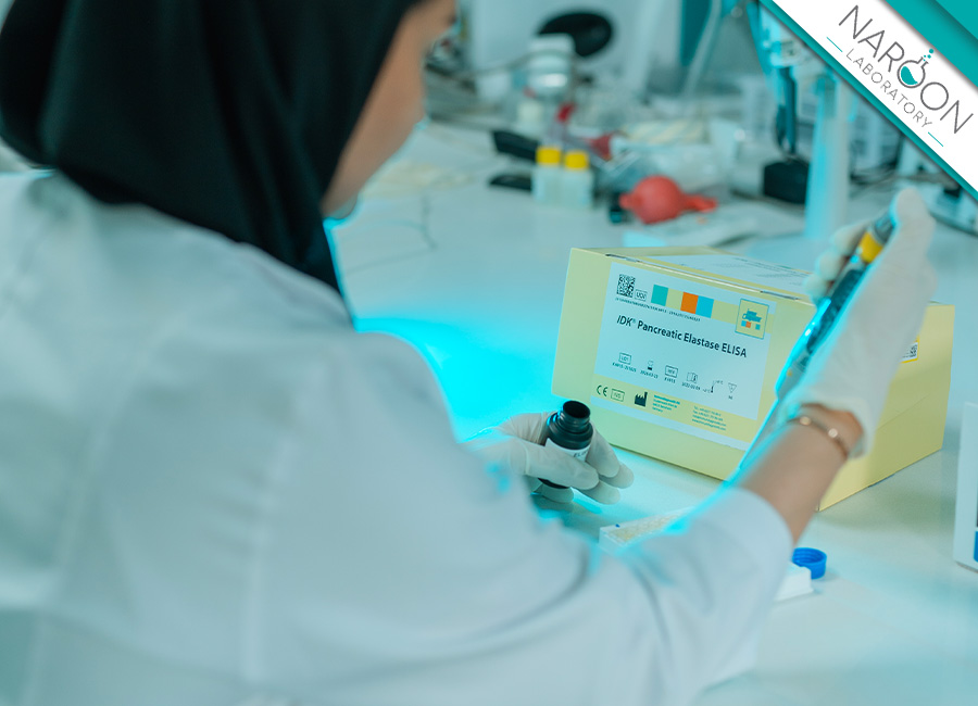 آزمایش تستوسترون در مردان