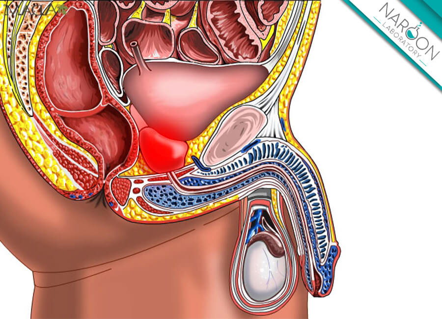علائم و خطرات بزرگ شدن پروستات