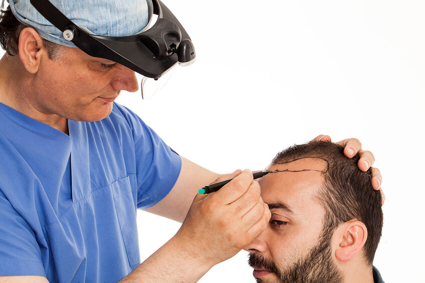 hair-transplant-1.jpg