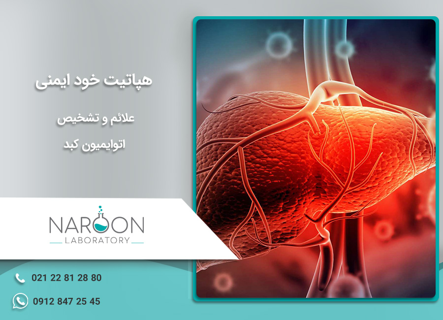 هپاتیت خود ایمنی