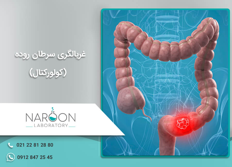 غربالگری سرطان روده